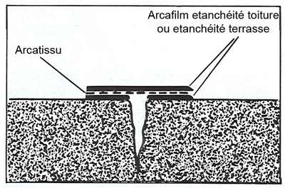 Arcatissu-fissure-1.png