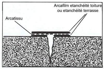 Arcatissu-fissure-1.png