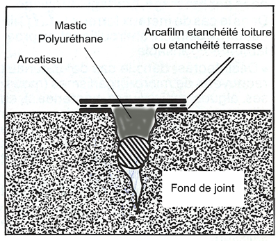 Arcatissu-fissure-2.png